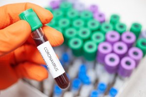 Два новых случая коронавируса на Сумщине обнаружили у медиков