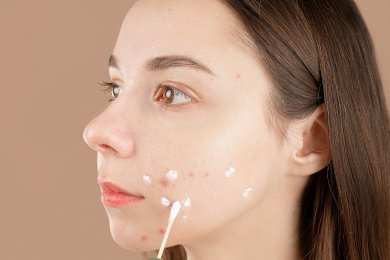 6 порад для догляду за проблемною шкірою