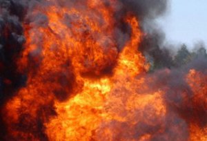 В Лебединском районе ребенок получил сильные ожоги
