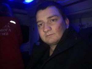 В Сумах напали на депутата от «Слуги народа» Михаила Ананченко