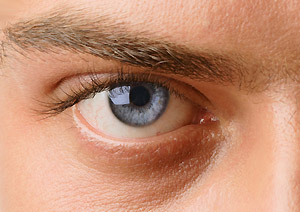 Сумчане могут бесплатно узнать,  не грозит ли им глаукома