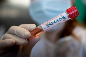 Сумской лабораторный центр получил тест-системы для определения коронавируса
