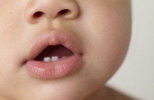 Что делать, когда режутся зубки у ребенка