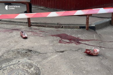 У Сумах чоловік отримав ножове поранення під час конфлікту та перебуває в лікарні