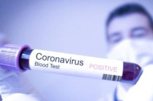 В Сумах первый подтвержденный случай коронавируса